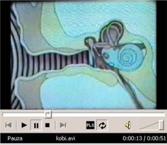 Kliknij aby obejrze� prezentacj� o budowie ucha [10MB]