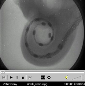 Kliknij aby obejrze� prezentacj� o umiejscowieniu elektrod wewn�trz �limaka [9,14MB]